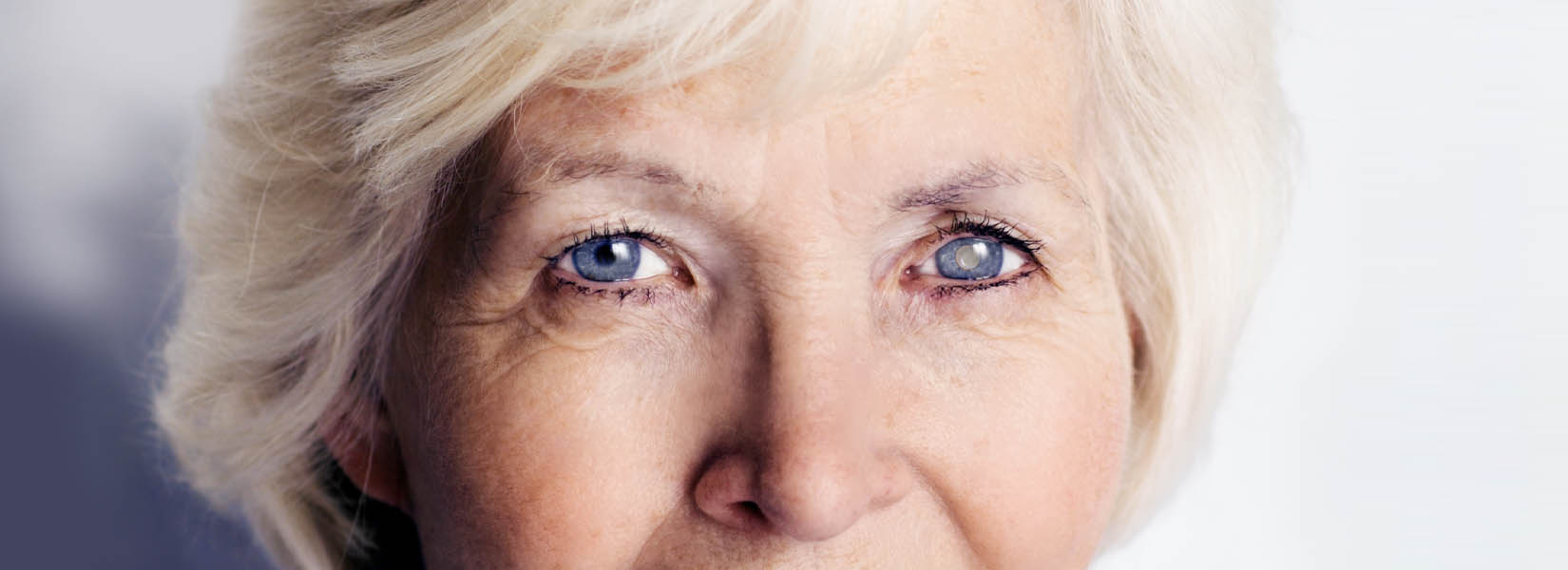 Cataract Surgery in Uptown